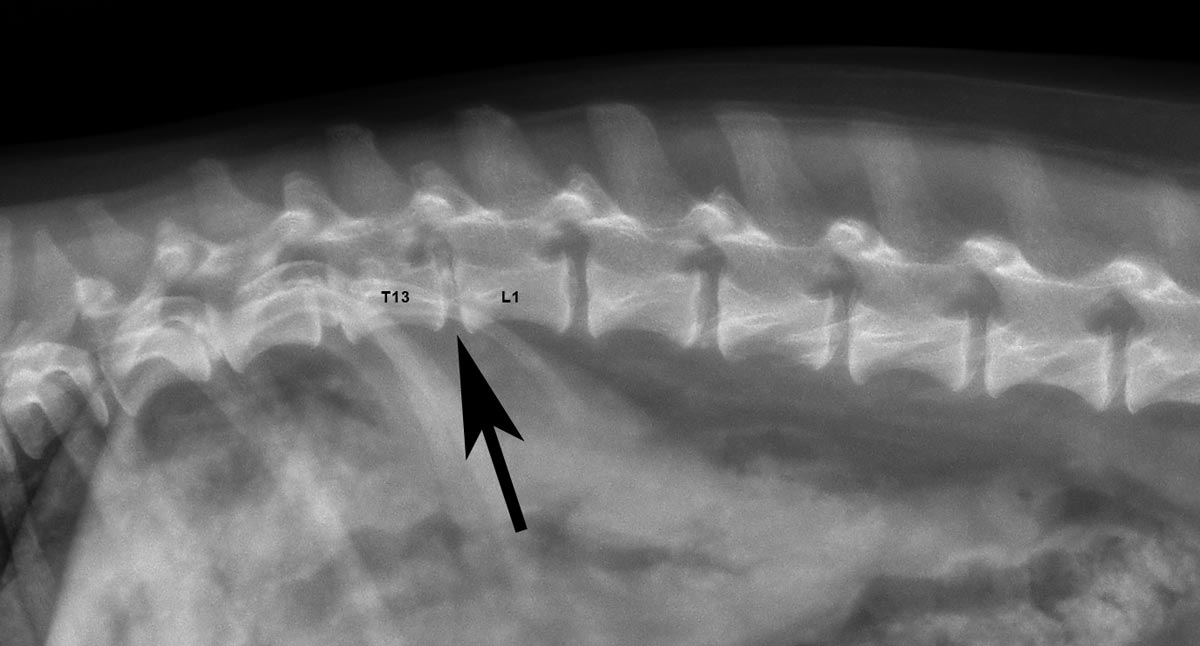 Ivdd Calcified Disc