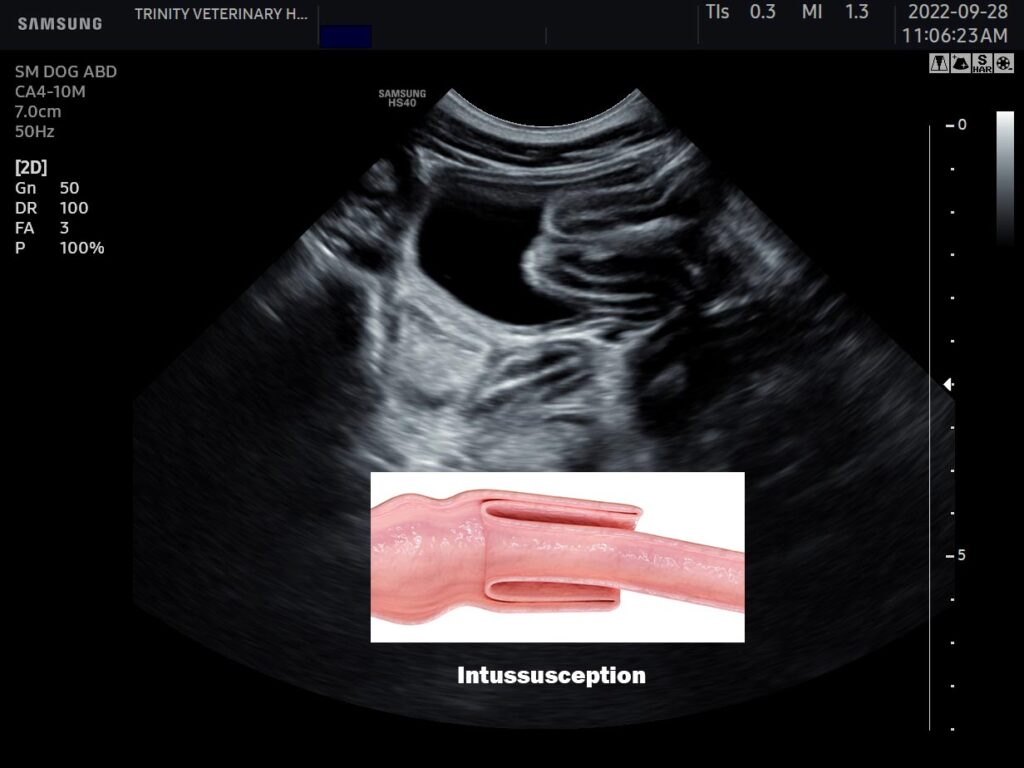 Ultrasound Showing Intussusception