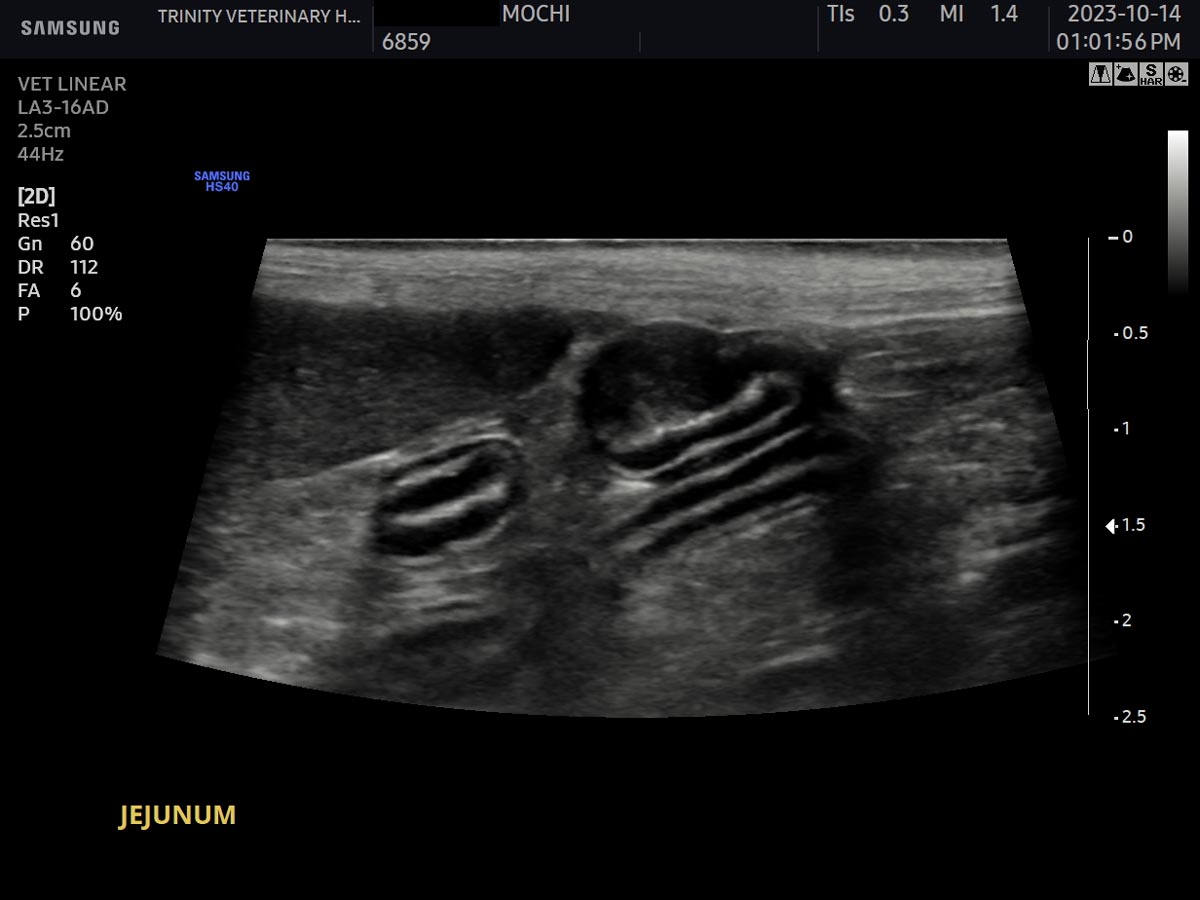 Mochi Mass On Jejunum
